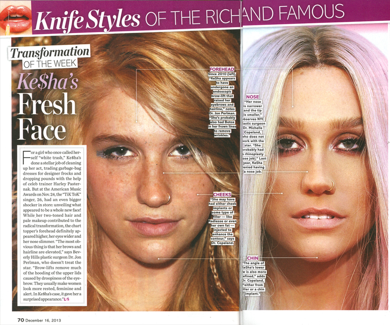 Illustration for article titled This Week in Tabloids: A Detailed Analysis of Ke$ha's Plastic Surgery